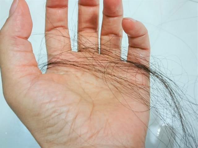 抜け毛